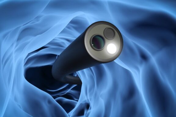 Grafika przedstawiająca wziernik we wnętrzu jelita.