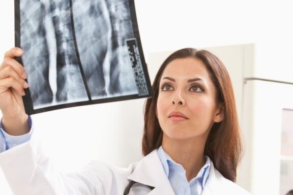 Lekarka oglądająca zdjęcie rentgenowskie pod światło.