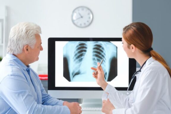 Pulmonolog pokazujący starszej pacjentce obraz płuc na zdjęciu RTG.